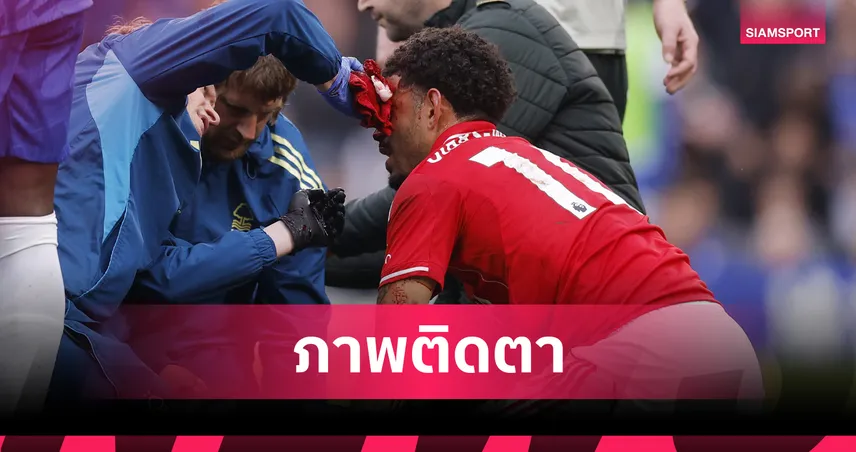 ใจเด็ด! มอร์แกน กิ๊บส์-ไวท์ สังเวยเลือดโชว์แผลเหวอะหน้าผาก ขอบคุณแฟนหลัง ฟอเรสต์ บุกขย้ำ เชลซี 103344