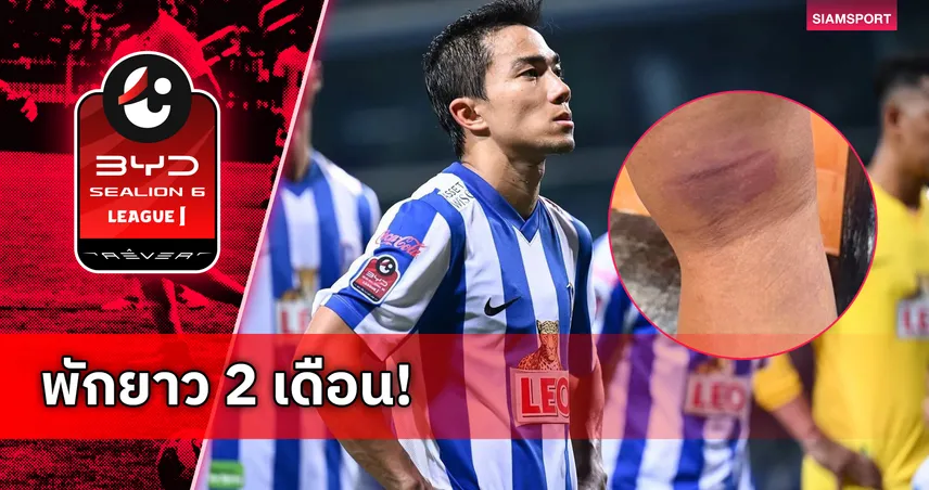 “เจ-ชนาธิป” เจ็บแฮมสตริงพัก 6-8 สัปดาห์ ชวดช่วยบีจีชิงเมืองไทย คัพ 103497