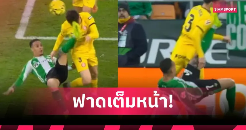 อันโตนี่ โดนแดง! จักรยานอากาศโดนหน้าคู่แข่ง เกม เบติส เสมอ จีโรน่า (มีคลิป) 94821