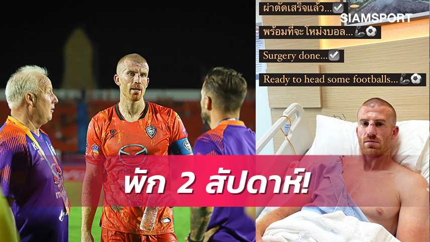 "ชาร์ลี คลัฟ"ผ่าตัดฉลุยคาดพักฟื้นราว2สัปดาห์ก่อนกลับช่วยโคราช